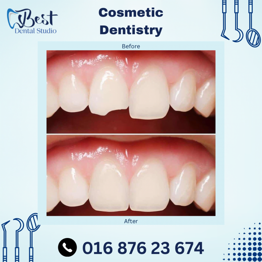 Cosmetic Dentistry