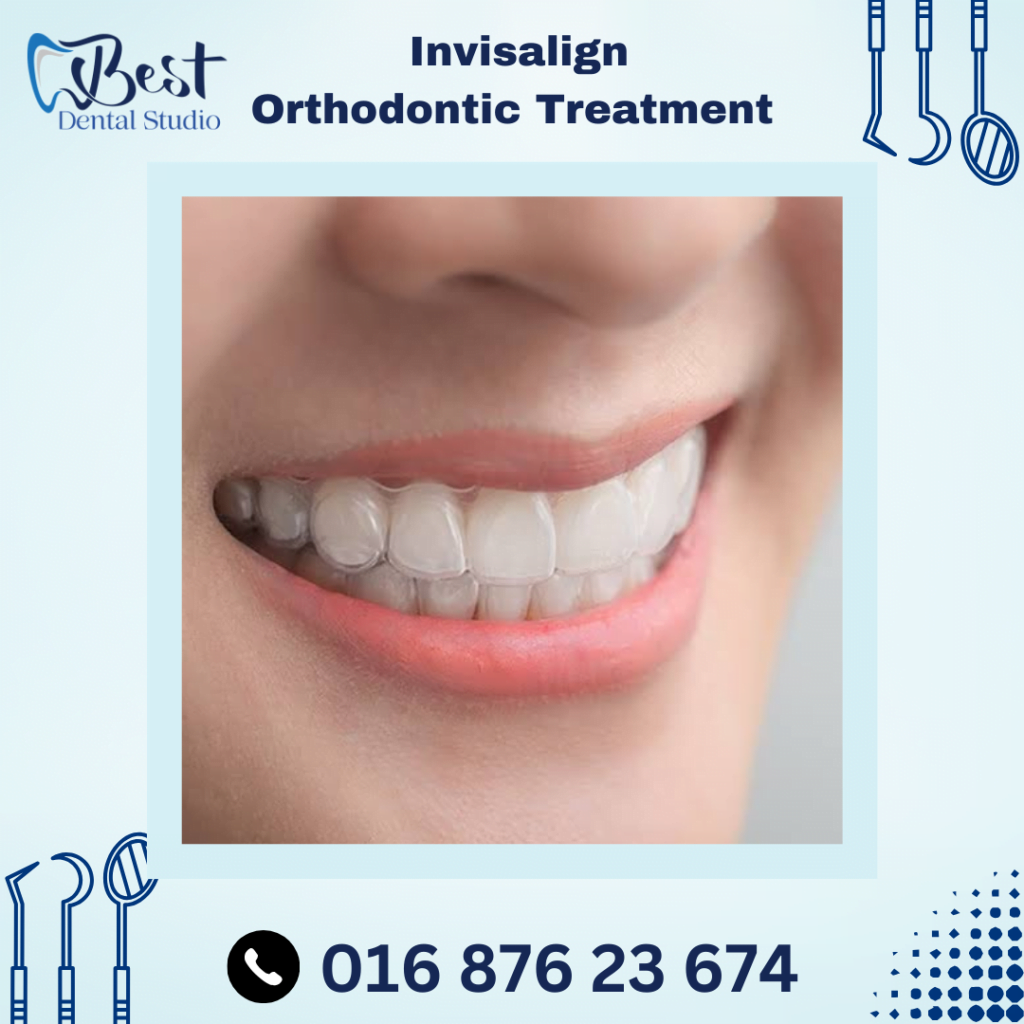 Invisalign Orthodontic Treatment