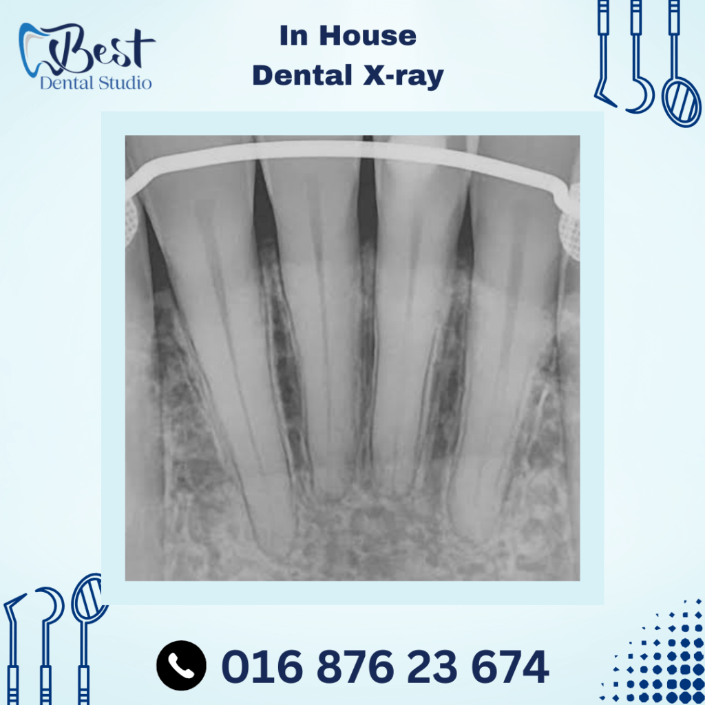 In House Dental X-Ray