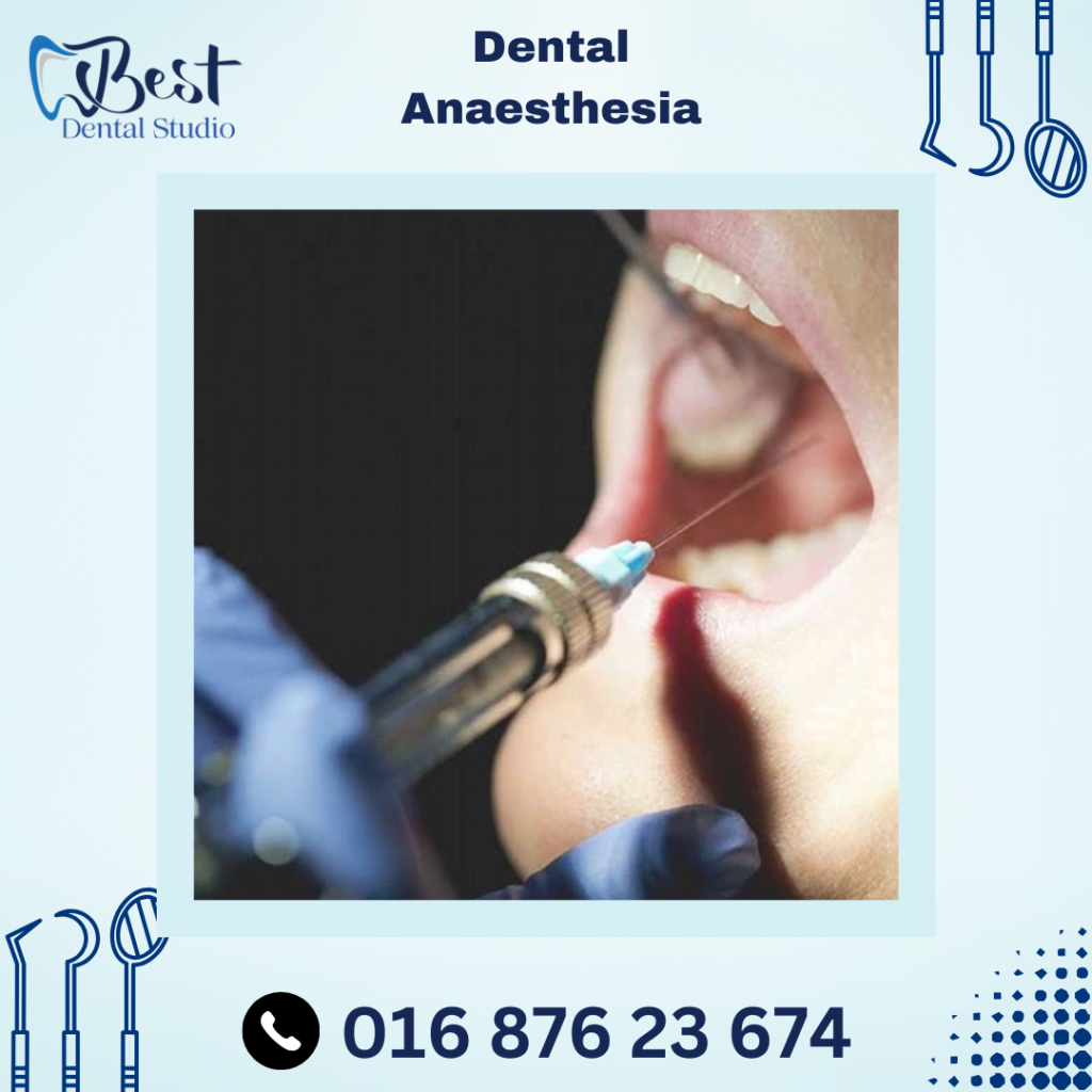 Dental Anaesthesia