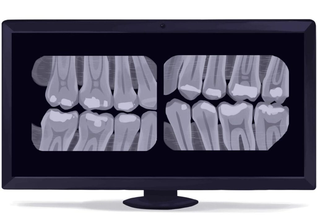 Dental Radiology