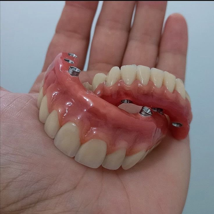 Complete Denture 1