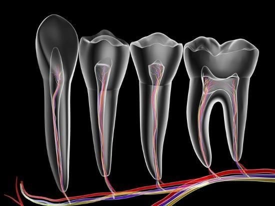 Root Canal Treatment 3